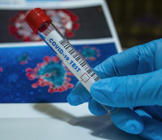 Coronavirus: in Toscana 92 casi in più rispetto a ieri, nessun decesso