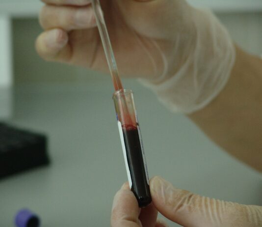 Coronavirus, in Toscana 113 casi e 41 guarigioni in più rispetto a ieri, nessun decesso