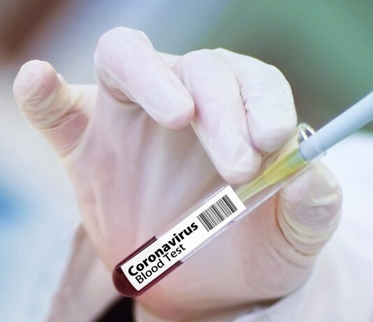 Coronavirus, in Toscana 40 casi in più rispetto a ieri e un decesso. In aumento le guarigioni