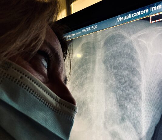 Covid-19: vedere il Virus attraverso i Raggi X