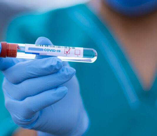 Coronavirus, 109 nuovi casi nell’aretino