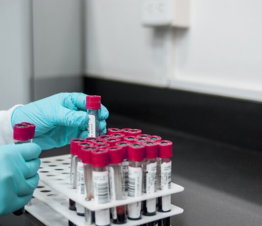 Coronavirus, 13 nuovi casi nell’aretino