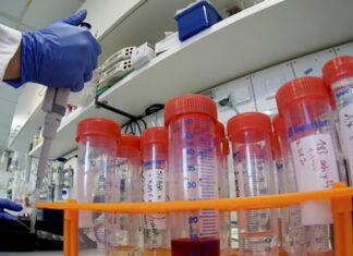 Coronavirus: 96 nuovi casi nell’aretino, 103 in degenza covid, 29 in terapia intensiva, 86 persone guarite, nessun decesso