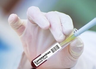 Coronavirus: 159 nuovi casi nell’aretino, 117 in degenza covid, 31 in terapia intensiva, 163 persone guarite, 2 decessi