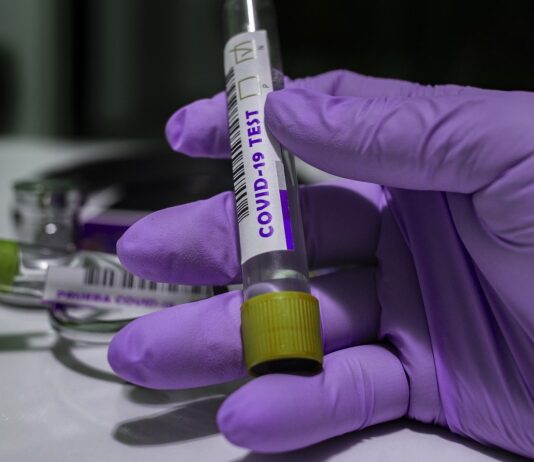 Coronavirus: 98 nuovi casi nell’aretino, 120 in degenza Covid, 32 in terapia intensiva, 86 persone guarite, 2 decessi