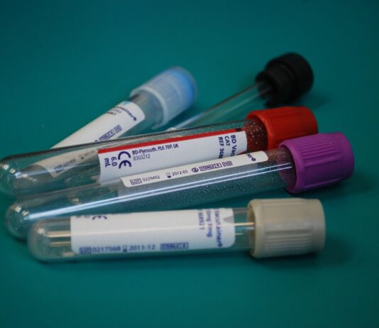 Coronavirus: 47 nuovi casi nell’aretino, 105 in degenza covid, 25 in terapia intensiva, 45 persone guarite, un decesso