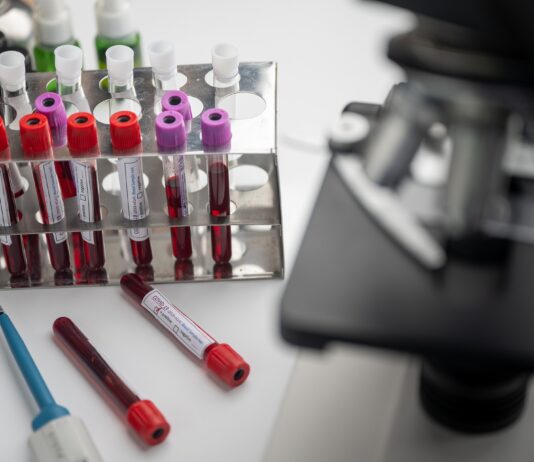 Coronavirus: 55 nuovi casi nell’aretino, 7 persone in degenza covid, 2 in terapia intensiva