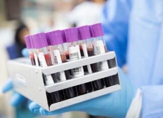 Coronavirus Toscana, 1.329 i nuovi casi