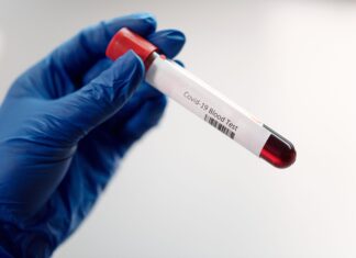 Coronavirus Toscana, 903 nuovi casi,Tre i decessi con età media di 84,7 anni