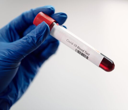 Coronavirus: In Toscana 2.166 nuovi casi. 9 decessi