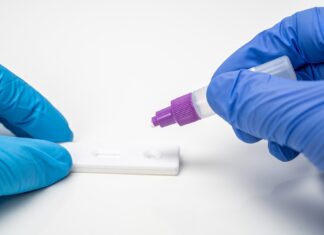 Coronavirus: in Toscana 169 nuovi casi e un decesso, di 87 anni d’età