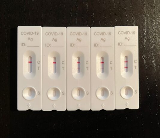 Coronavirus, 611 casi negli ultimi sette giorni. I decessi sono 28