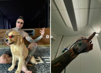 Riecco Fedez con un cane (che sembra Paloma ma non lo è). E spunta la foto con la flebo
